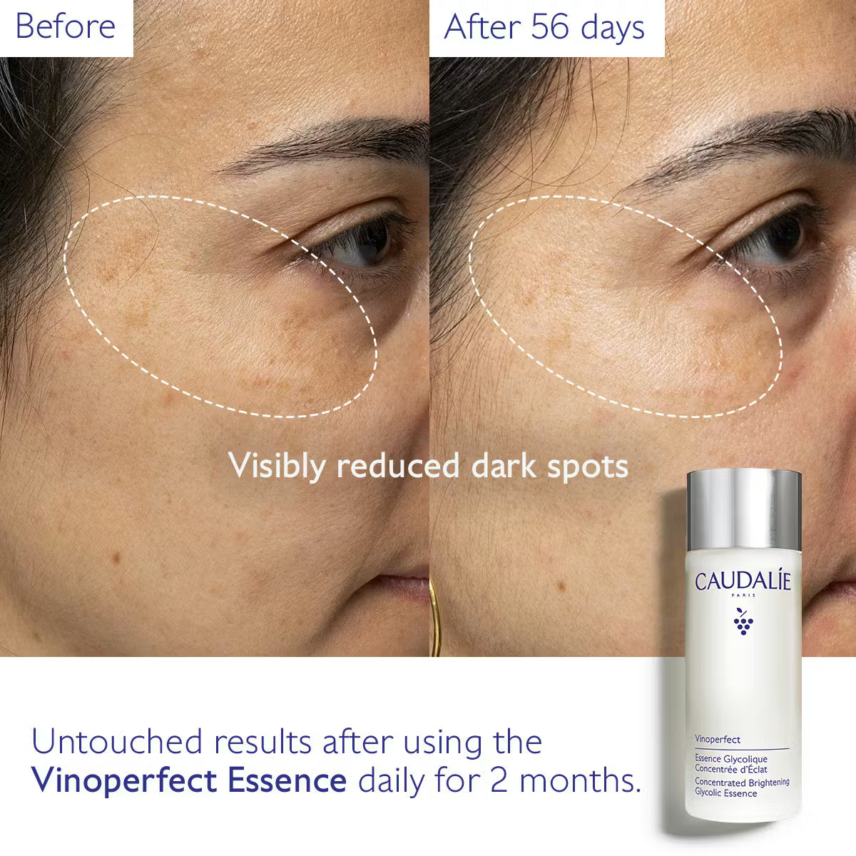 Caudalie Vinoperfect Glycolic Essence