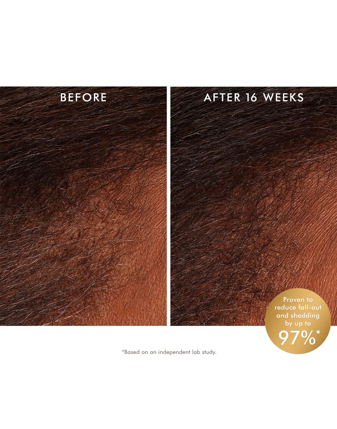 Moroccanoil Scalp Revitalizing Tonik 100ml