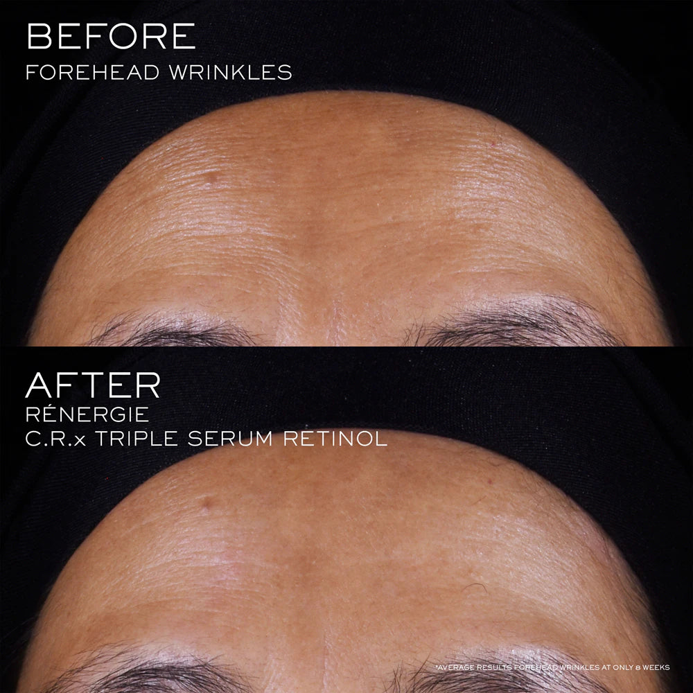 Rénergie C.R.X. Triple Retinol