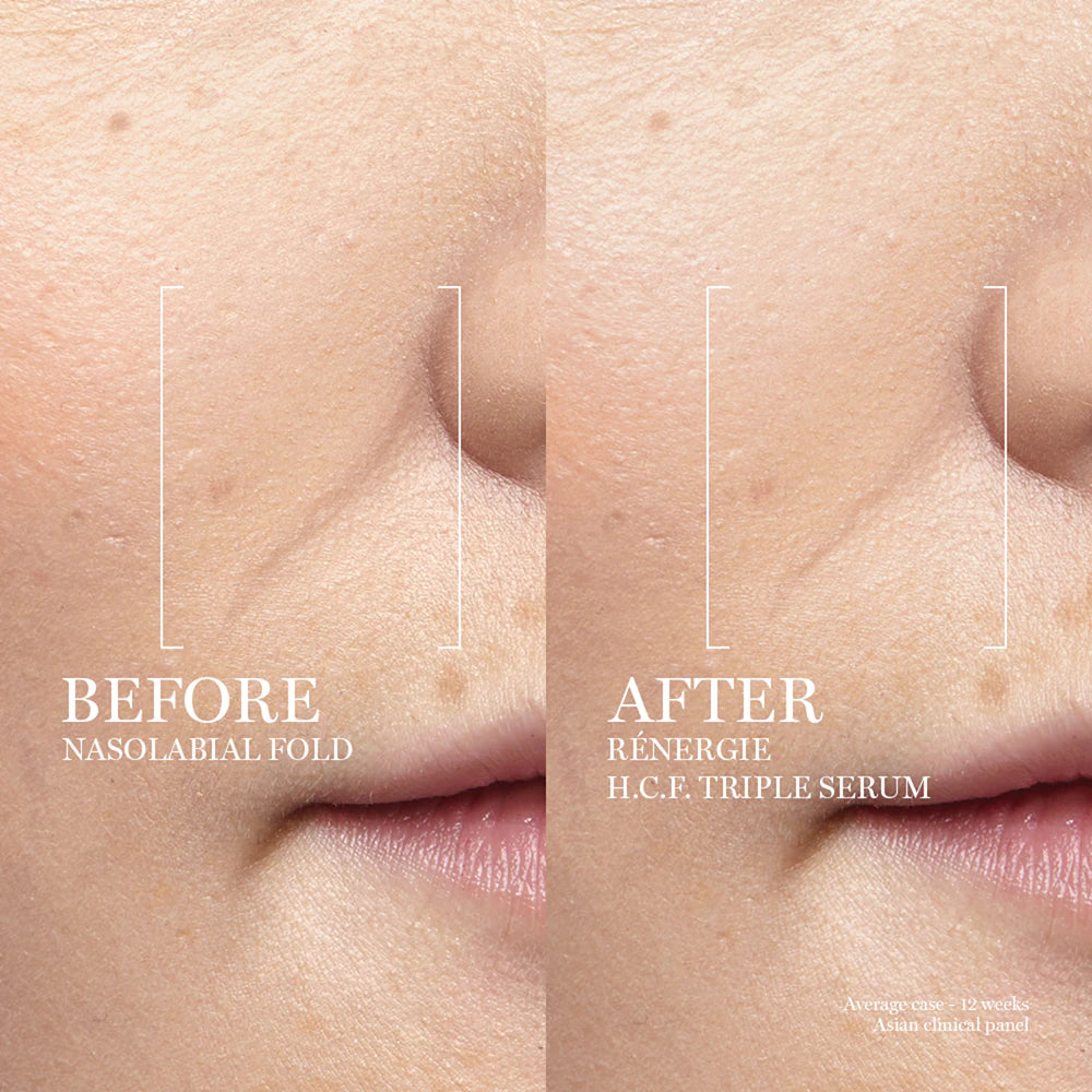 Lancôme Rénergie H.C.F. Triple Serum – 20 ml